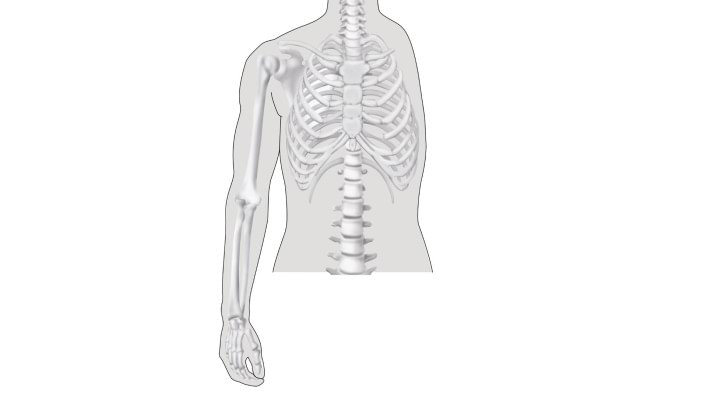 Schultergürtelamputation